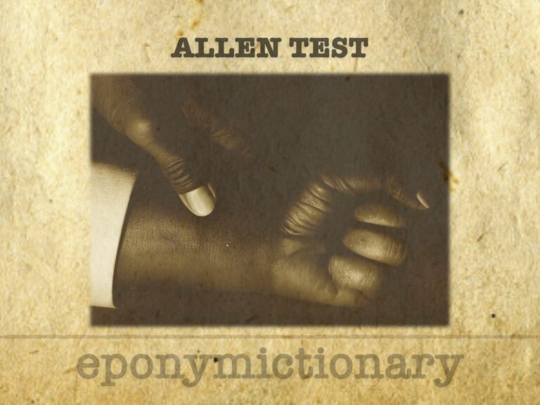 Allen test 680