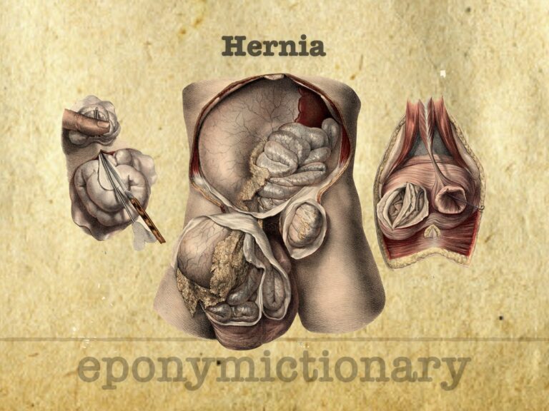 eponymous hernia 680