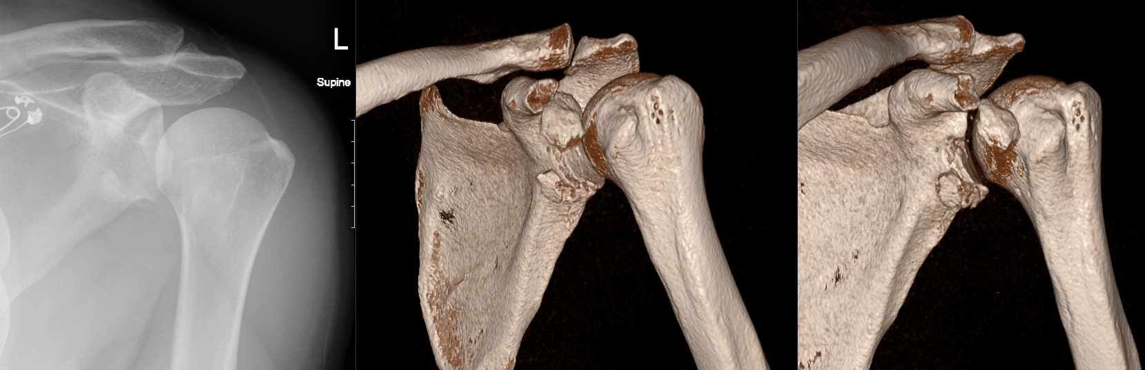 CT Case 104 001