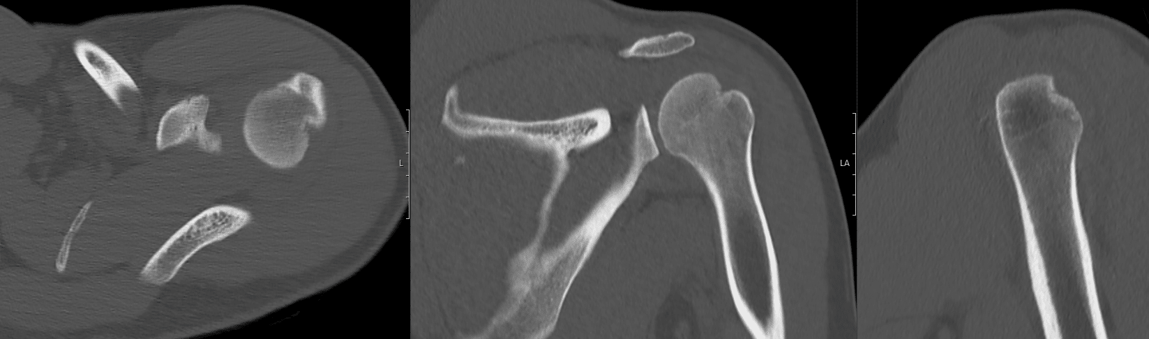 CT Case 104 002
